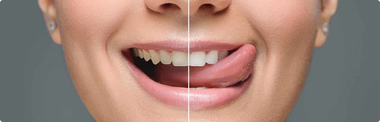odontologia estética na implatomed DF